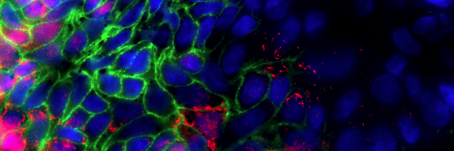 Hier ist eine Mikroskopie Aufnahme eines Darm Organoids zu sehen.