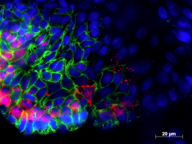 Hier ist eine Mikroskopie Aufnahme eines Darm Organoids zu sehen.